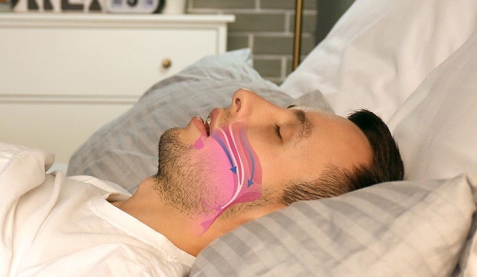 best cure for snoring